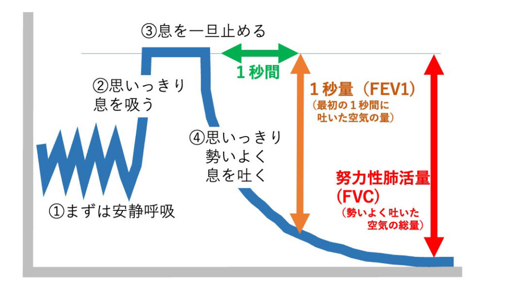 呼吸機能検査（スパイロメトリー）