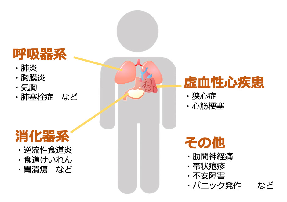 胸痛・胸の痛みとは